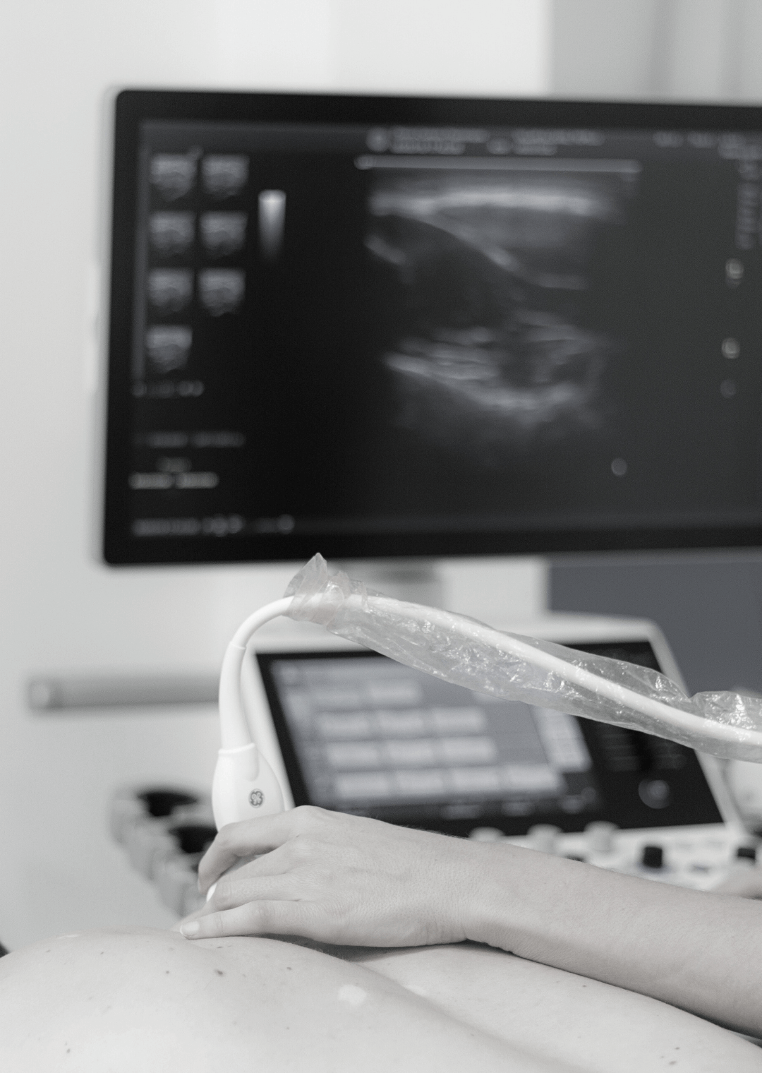 XLIV Ecografía Musculoesquelética